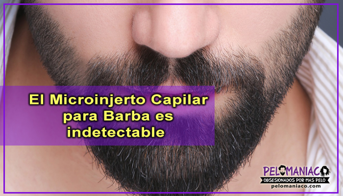 microinjerto capilar para barba indetectable